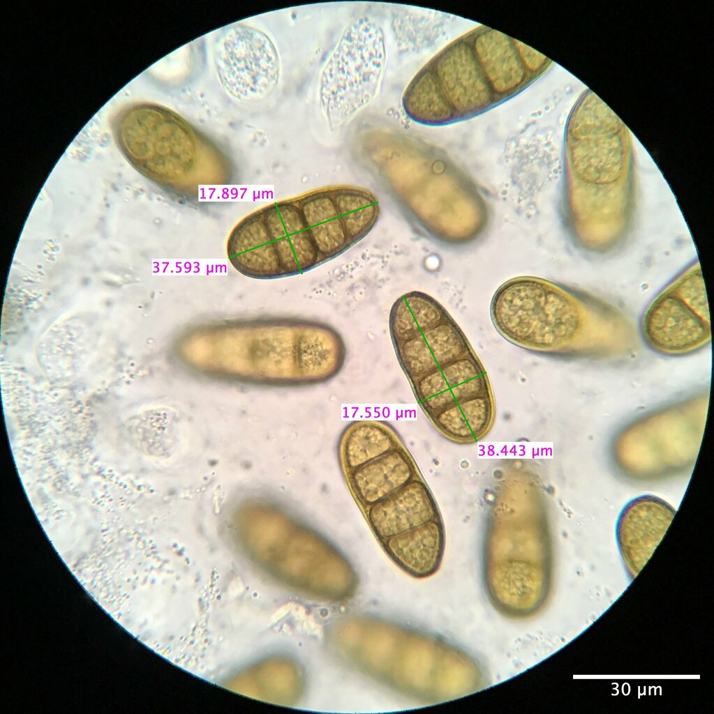 Macrodiplodiopsidaceae