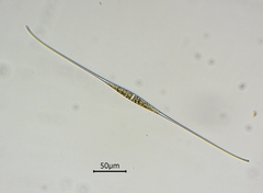 Closterium kuetzingii