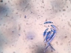 Pseudolachnea hispidula
