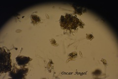 Peronospora destructor