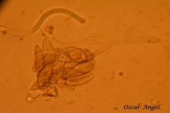 Peronospora destructor