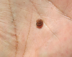 Calliostoma supragranosum
