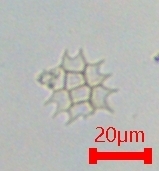Pseudopediastrum
