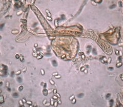 Tricholomopsis scabra