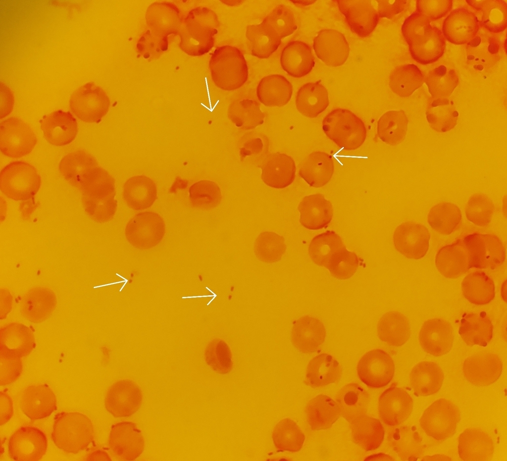 Haemophilus influenzae in June 2022 by Timothy Loh. Gram stain of H ...