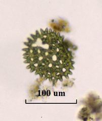 Pediastrum