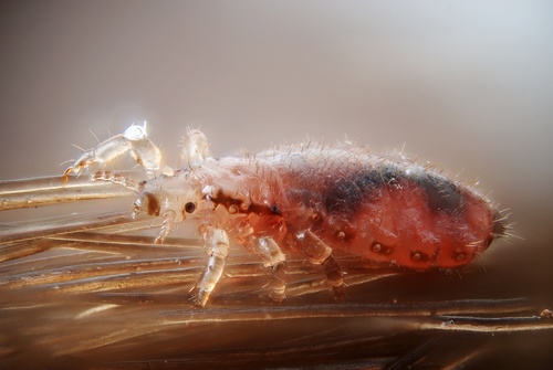 Head louse