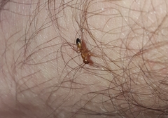 Camponotus snellingi