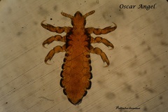Pediculus humanus