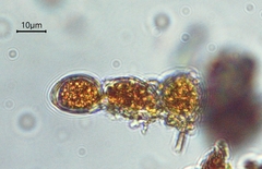 Trentepohlia umbrina