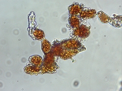 Trentepohlia umbrina