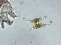 Staurastrum anatinum