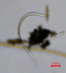 Nematoda