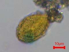 Surirella