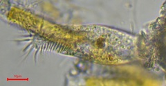 Ciliophora