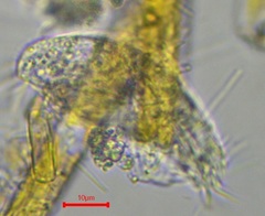 Ciliophora