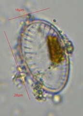 Surirella