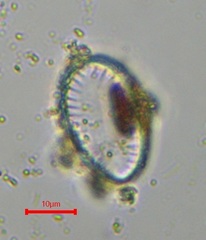 Surirella