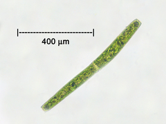 Pleurotaenium trabecula