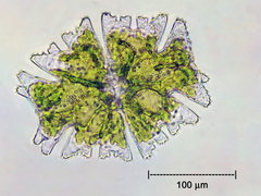Micrasterias americana