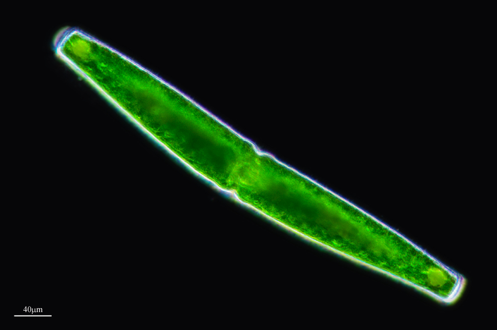 Pleurotaenium trabecula