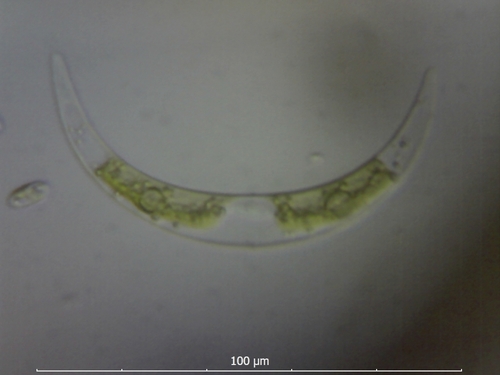 Closterium parvulum