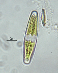Closterium navicula