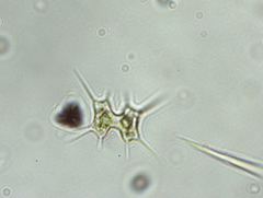 Xanthidium octocorne