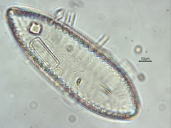 Surirella robusta
