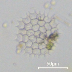 Pseudopediastrum