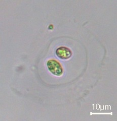 Oocystis