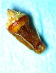 Rhynchospora harveyi