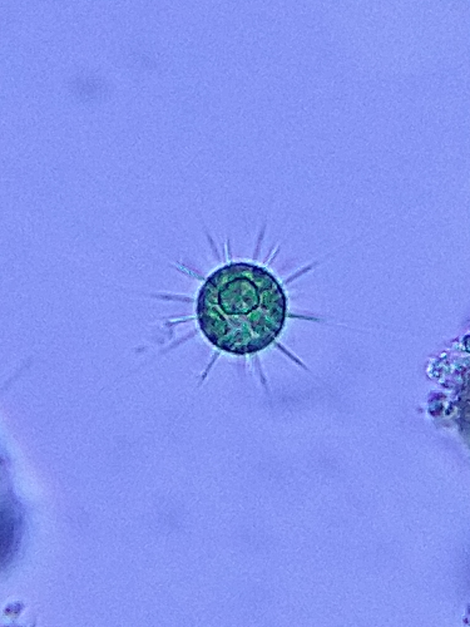 Acanthosphaera