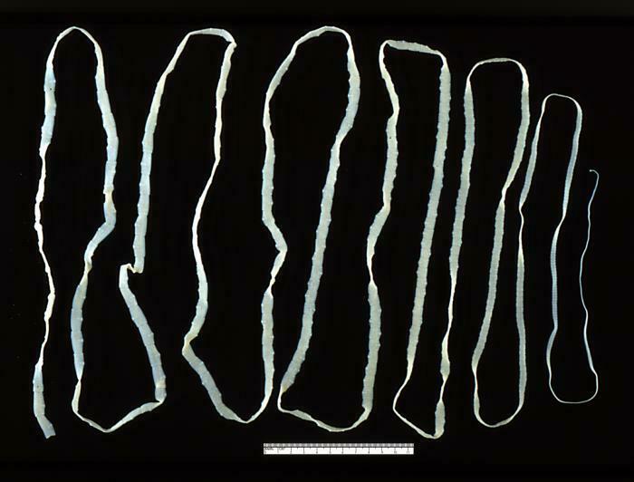 tapeworms