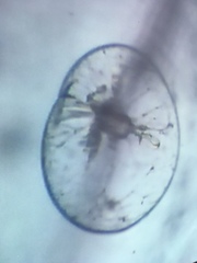 Noctiluca scintillans