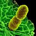 Klebsiella pneumoniae - Photo 
National Institute of Allergy and Infectious Diseases (NIAID), no known copyright restrictions (public domain)