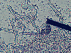Ceriporia purpurea