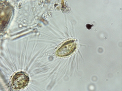 Mallomonas caudata