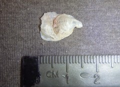 Malleus regula