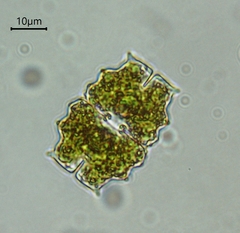 Euastrum turneri