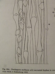 Trechispora hymenocystis