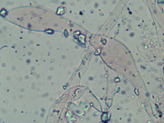Trechispora hymenocystis