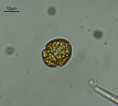 Parvodinium umbonatum