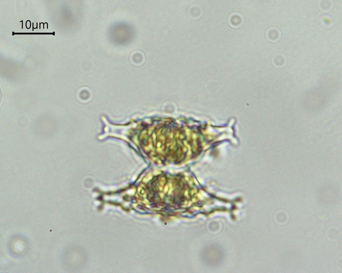 Staurastrum distentum