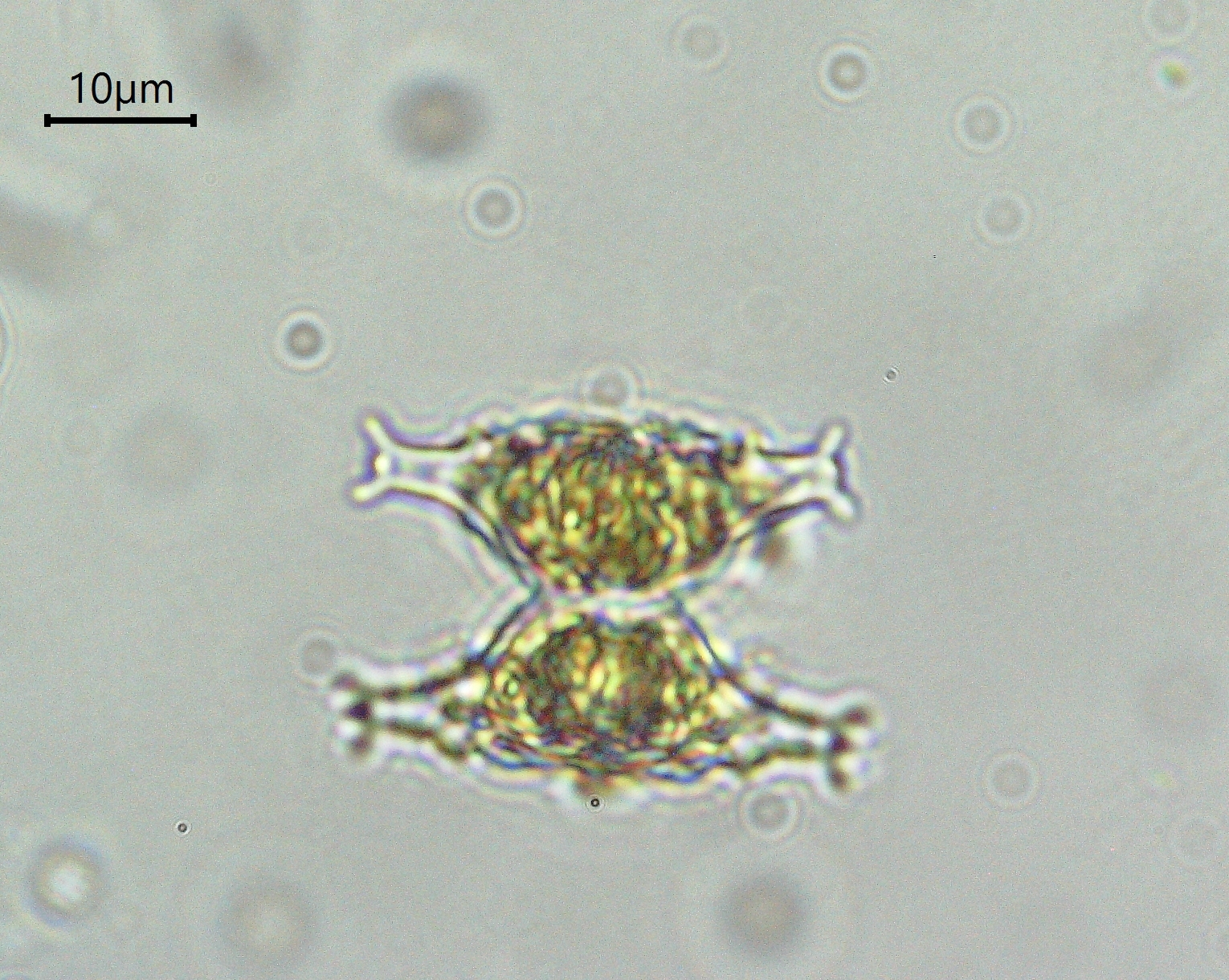 Staurastrum distentum