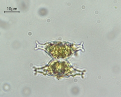 Staurastrum distentum