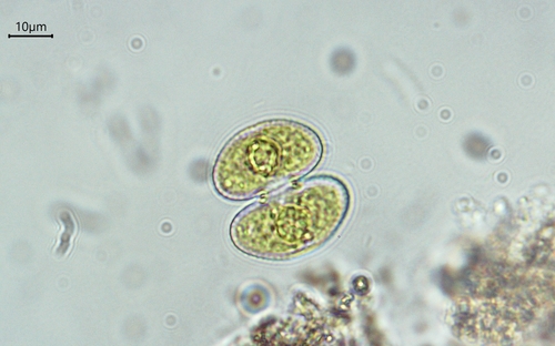 Cosmarium phaseolus