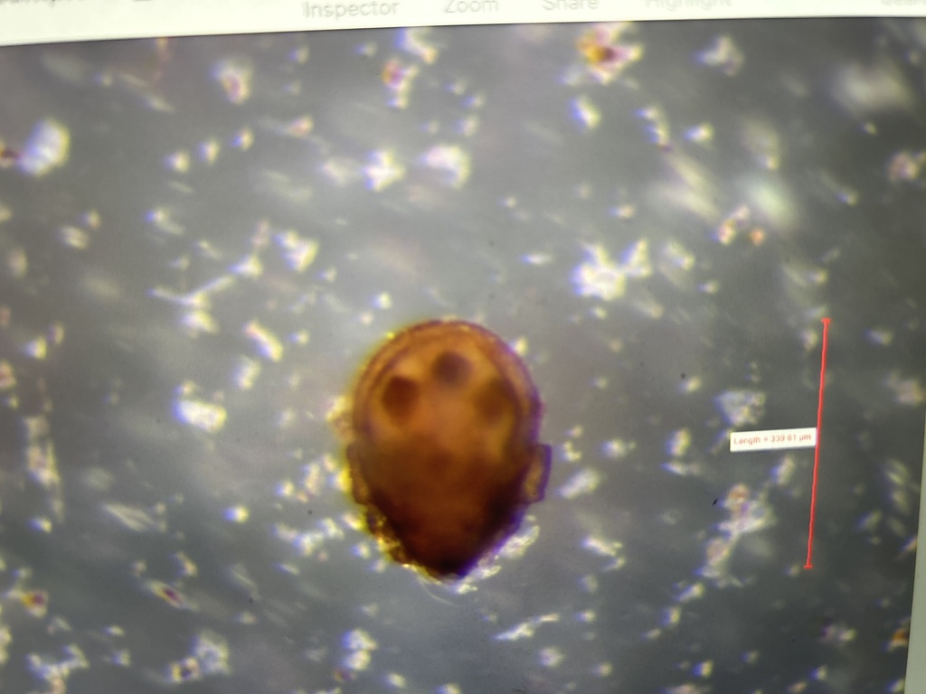 Haplozetidae