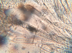 Coccomyces strobi