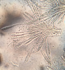 Coccomyces strobi